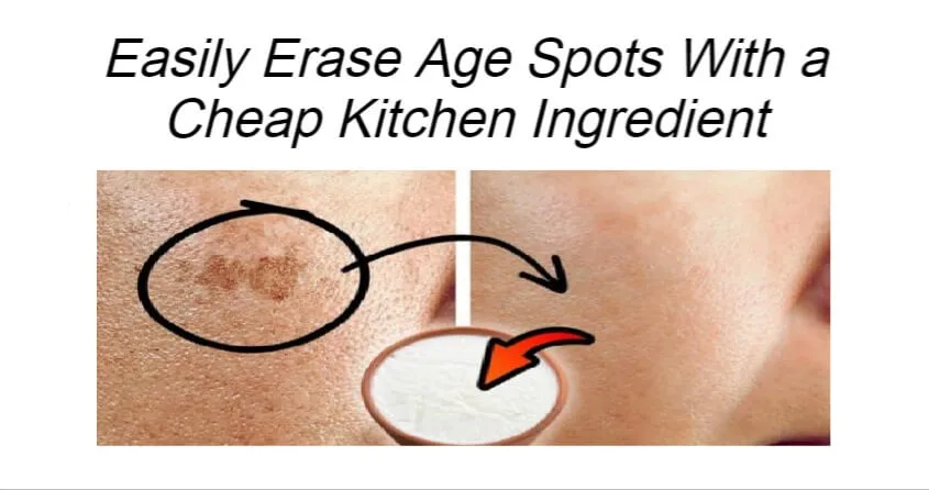 Read more about the article Easily Erase Age Spots With a Cheap Kitchen Ingredient