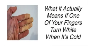 Read more about the article What It Actually Means If One of Your Fingers Turns White When It’s Cold