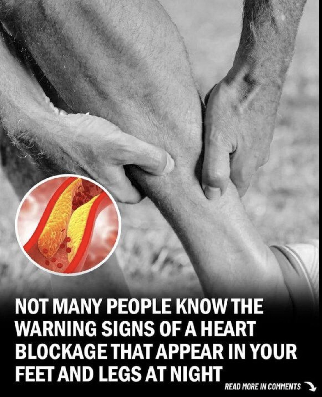 Read more about the article How Your Feet Can Warn You About Heart Disease and Clogged Arteries