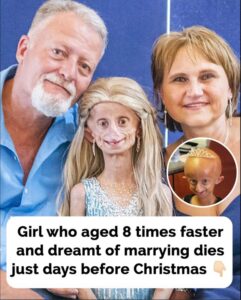 Read more about the article Beandri Booysen: A South African Girl’s Battle with Progeria and Her Lasting Legacy
