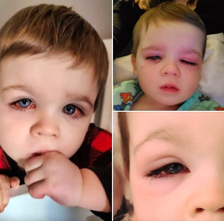 Read more about the article Warning About Bath Toys: How One Mom’s Experience Nearly Cost Her Toddler His Sight