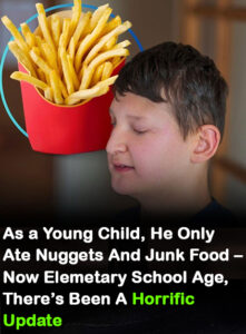 Read more about the article Boy Goes Permanently Blind Due to Poor Diet: A Wake-Up Call on Vitamin A Deficiency