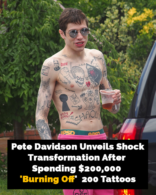 Read more about the article Pete Davidson’s Tattoo Removal Journey: A New Look and a New Chapter