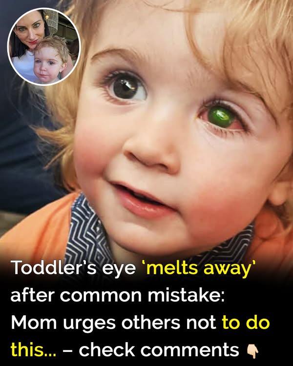 Read more about the article Toddler Faces Eye Damage After Herpes from Kiss – A Cautionary Tale for Parents