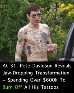 Read more about the article Pete Davidson’s Journey of Recovery: Why He’s Spending $200K to Remove His Tattoos