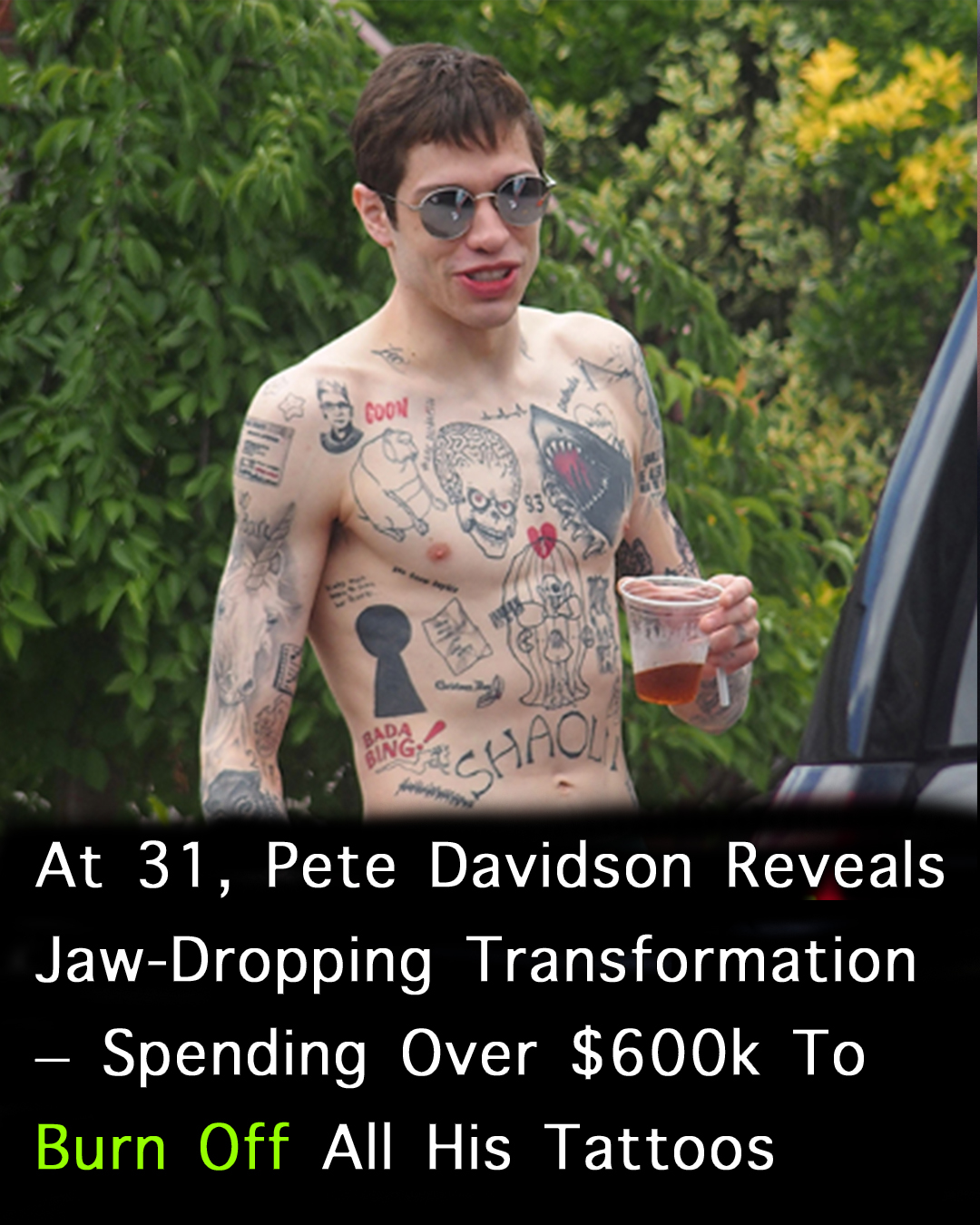 Read more about the article Pete Davidson’s Journey of Recovery: Why He’s Spending $200K to Remove His Tattoos