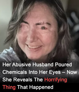 Read more about the article Survivor of Domestic Abuse Shares Her Story of Strength and Survival