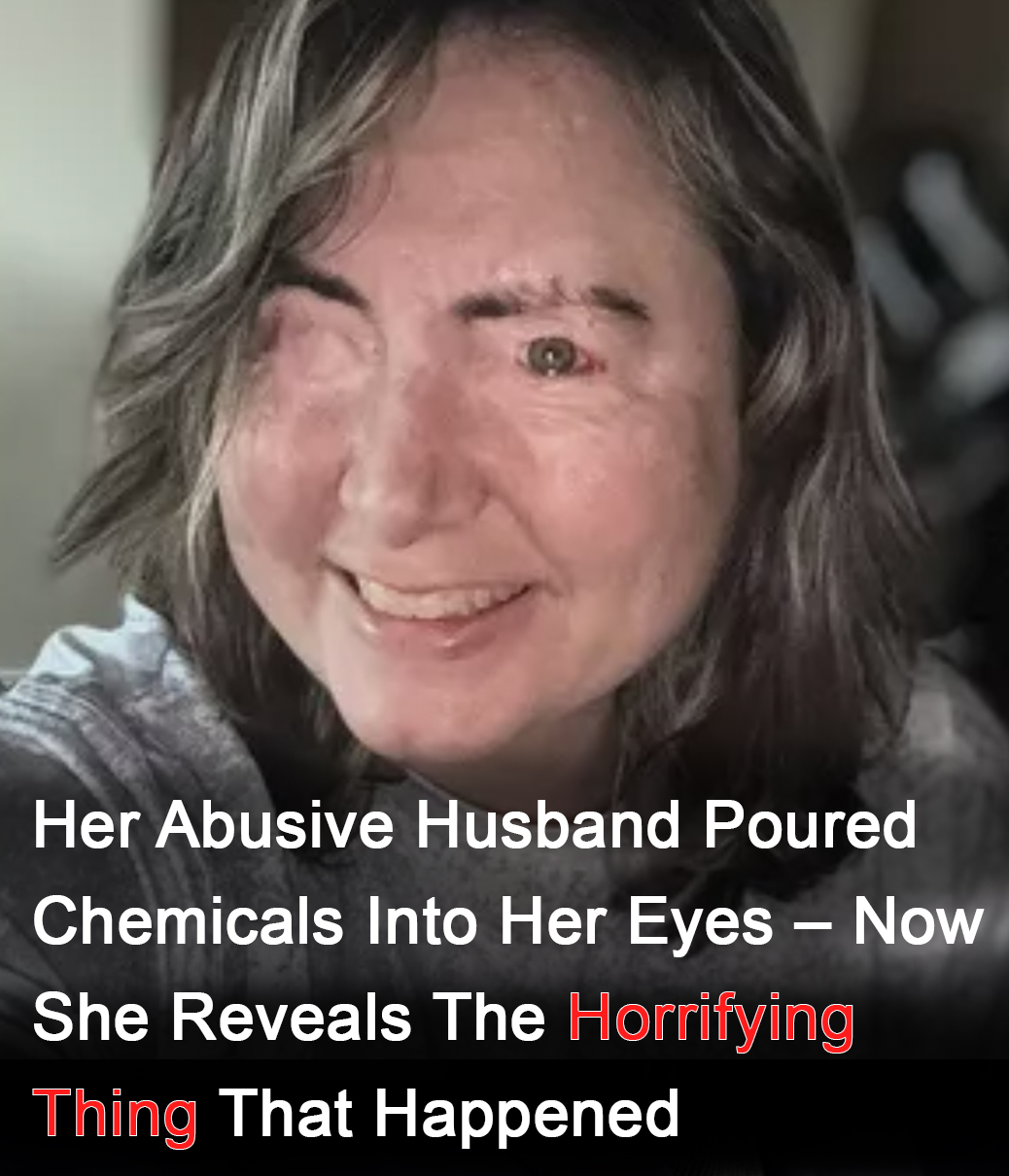 You are currently viewing Survivor of Domestic Abuse Shares Her Story of Strength and Survival