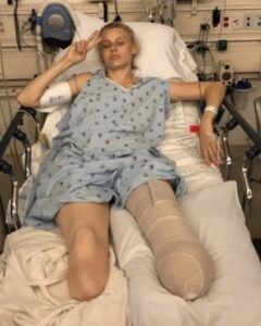 Read more about the article Lauren Wasser’s Brave Journey: A Warning About Menstrual Toxic Shock Syndrome