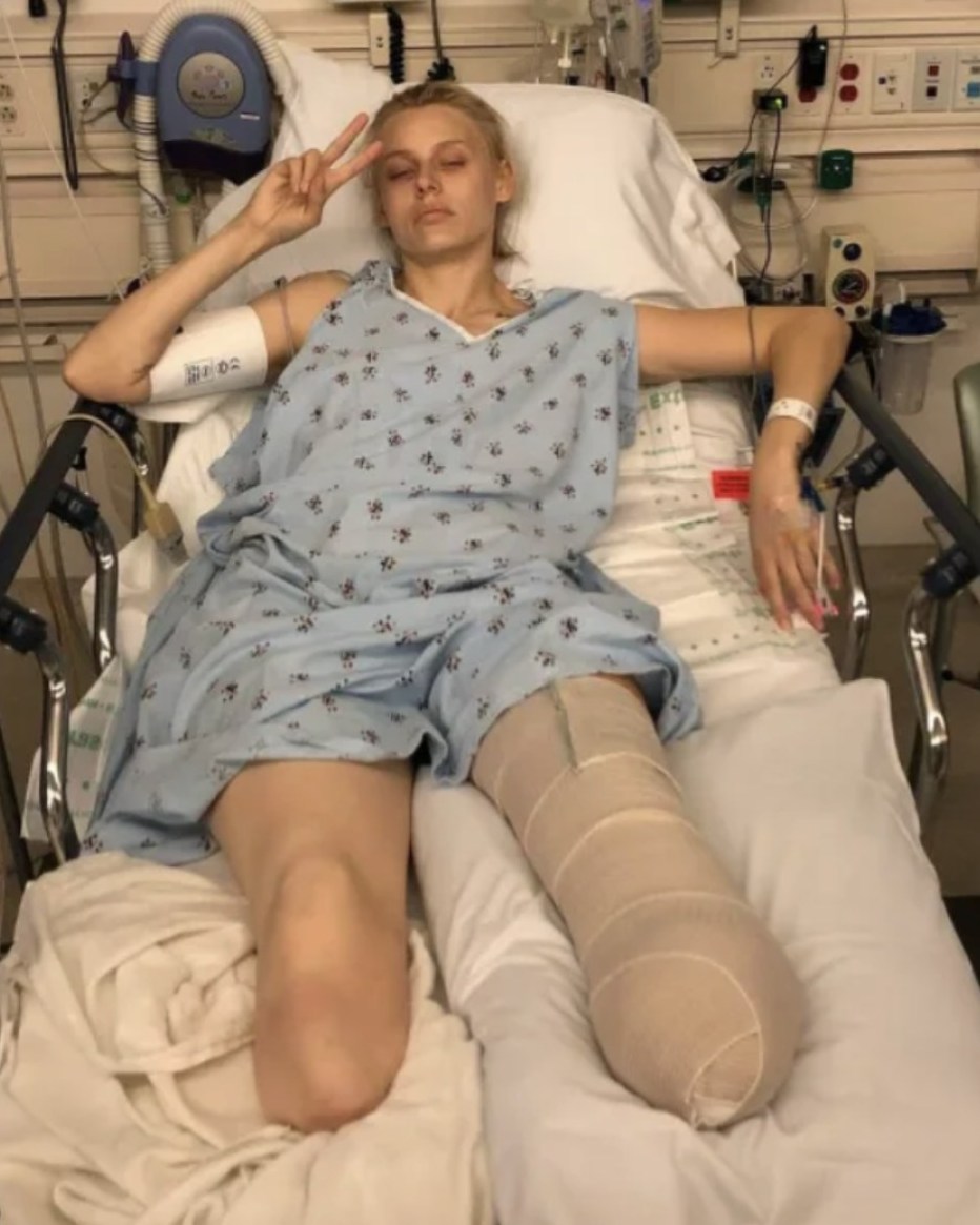 You are currently viewing Lauren Wasser’s Brave Journey: A Warning About Menstrual Toxic Shock Syndrome