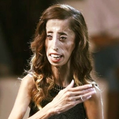 Read more about the article Lizzie Velásquez: A Story of Strength, Resilience, and Empowerment in 2024