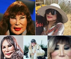 Read more about the article The Sad Tragedy Behind Lyn May’s Face: A Journey of Struggles, Fame, and Resilience