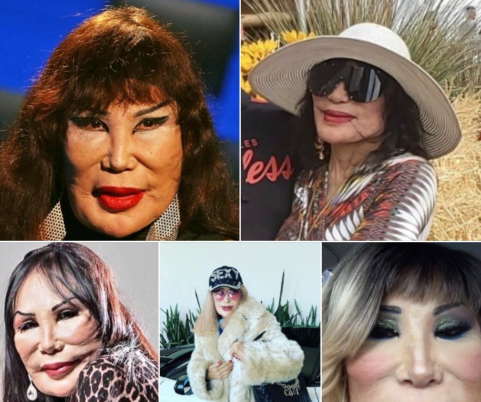 Read more about the article The Sad Tragedy Behind Lyn May’s Face: A Journey of Struggles, Fame, and Resilience