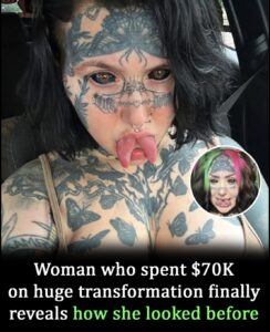 Read more about the article Title: Orylan’s $70K Transformation: The Shocking Before-and-After Photos That Will Leave You Stunned