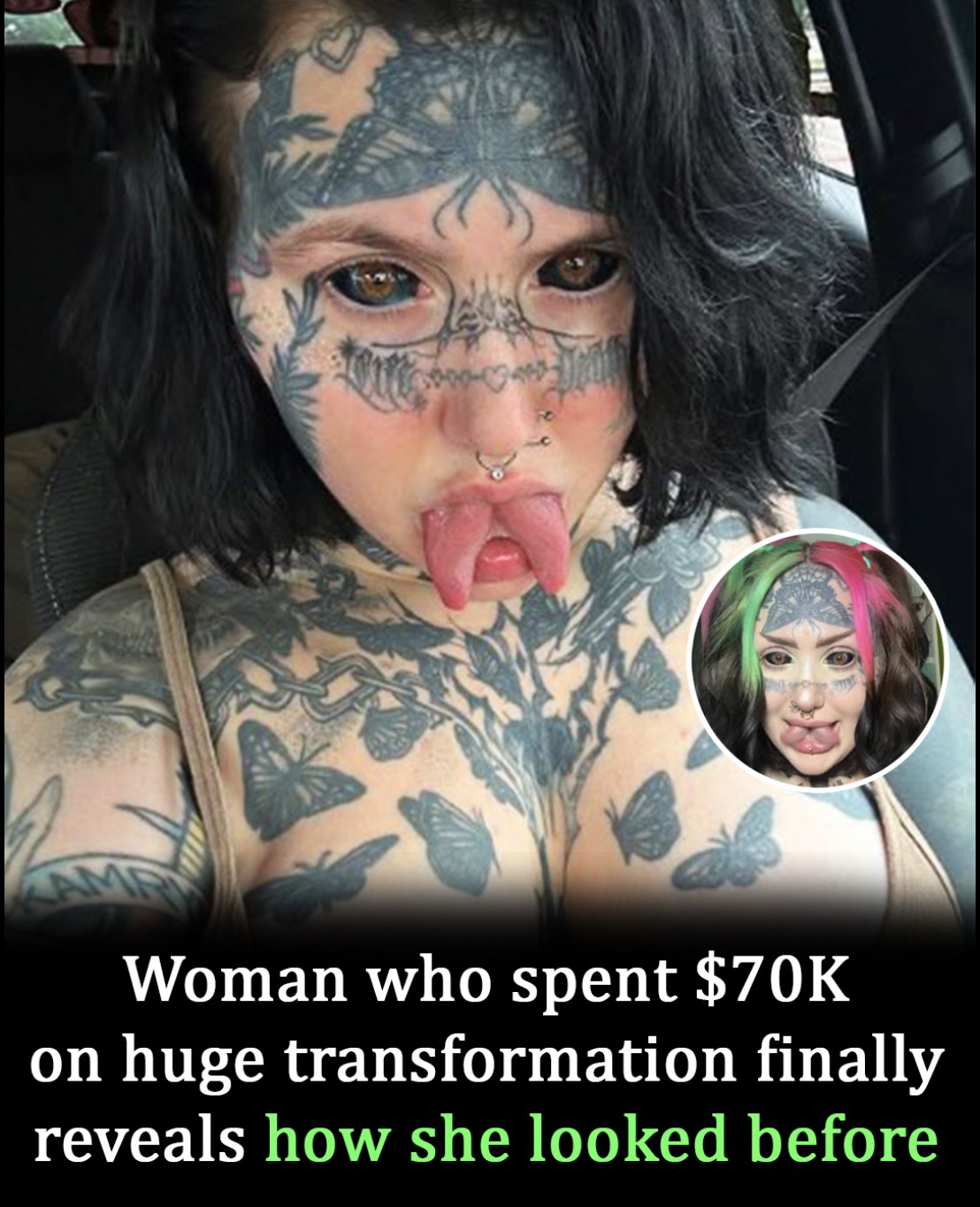 You are currently viewing Title: Orylan’s $70K Transformation: The Shocking Before-and-After Photos That Will Leave You Stunned