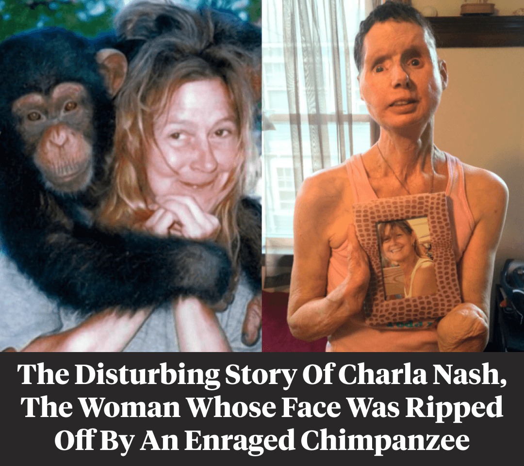 You are currently viewing The Sad Story of Charla Nash, the Woman Whose Face Was Ripped Off by a Chimpanzee