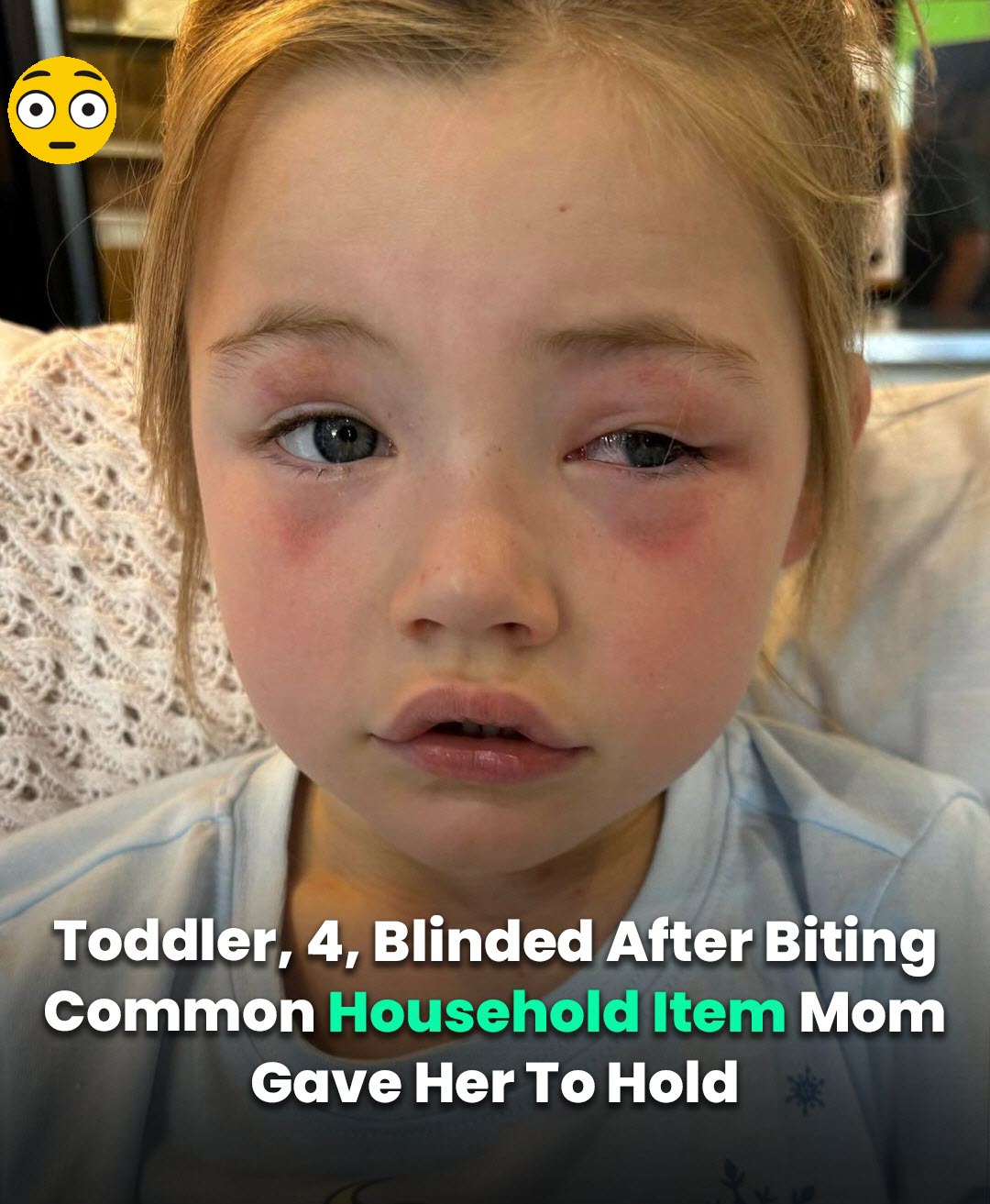 You are currently viewing Mom Warns Parents After Detergent Pod Blinds 4-Year-Old Daughter in Horrifying Incident