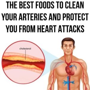 Read more about the article 10 Beneficial Foods for Maintaining Clean Arteries