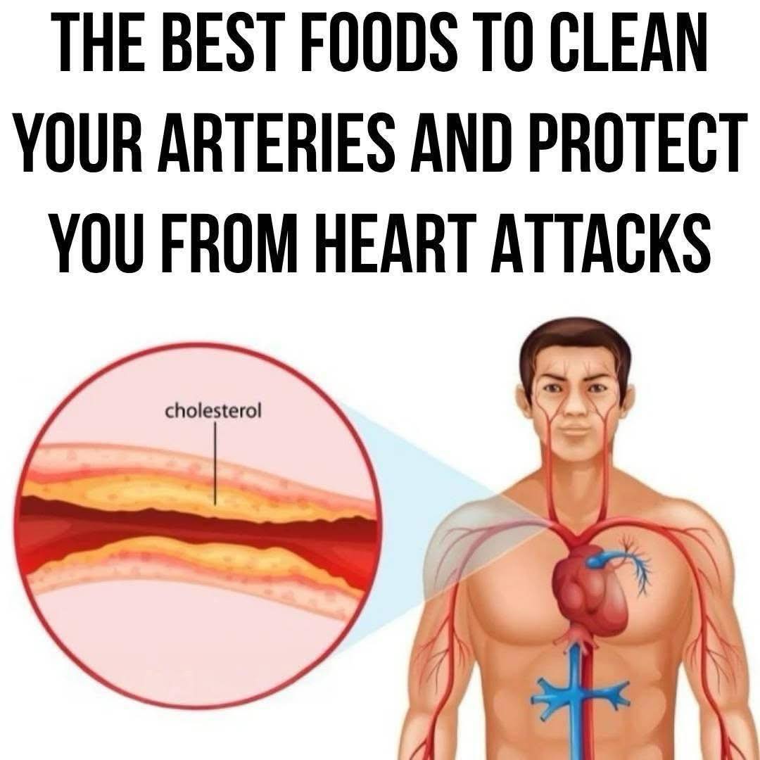 Read more about the article 10 Beneficial Foods for Maintaining Clean Arteries
