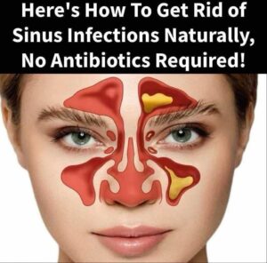 Read more about the article How to Stop a Difficult Sinus Infection Fast with Apple Cider Vinegar