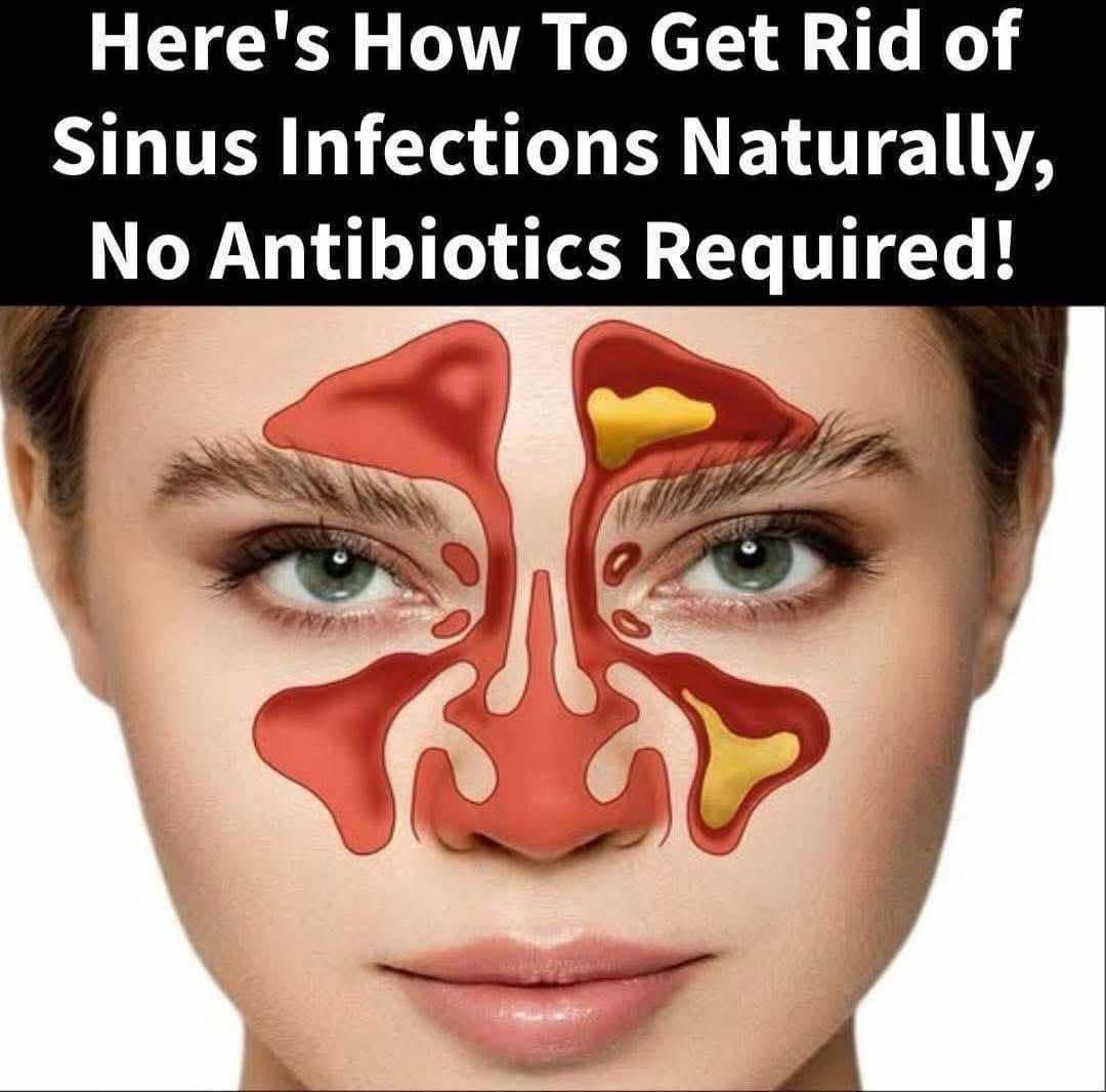 Read more about the article How to Stop a Difficult Sinus Infection Fast with Apple Cider Vinegar