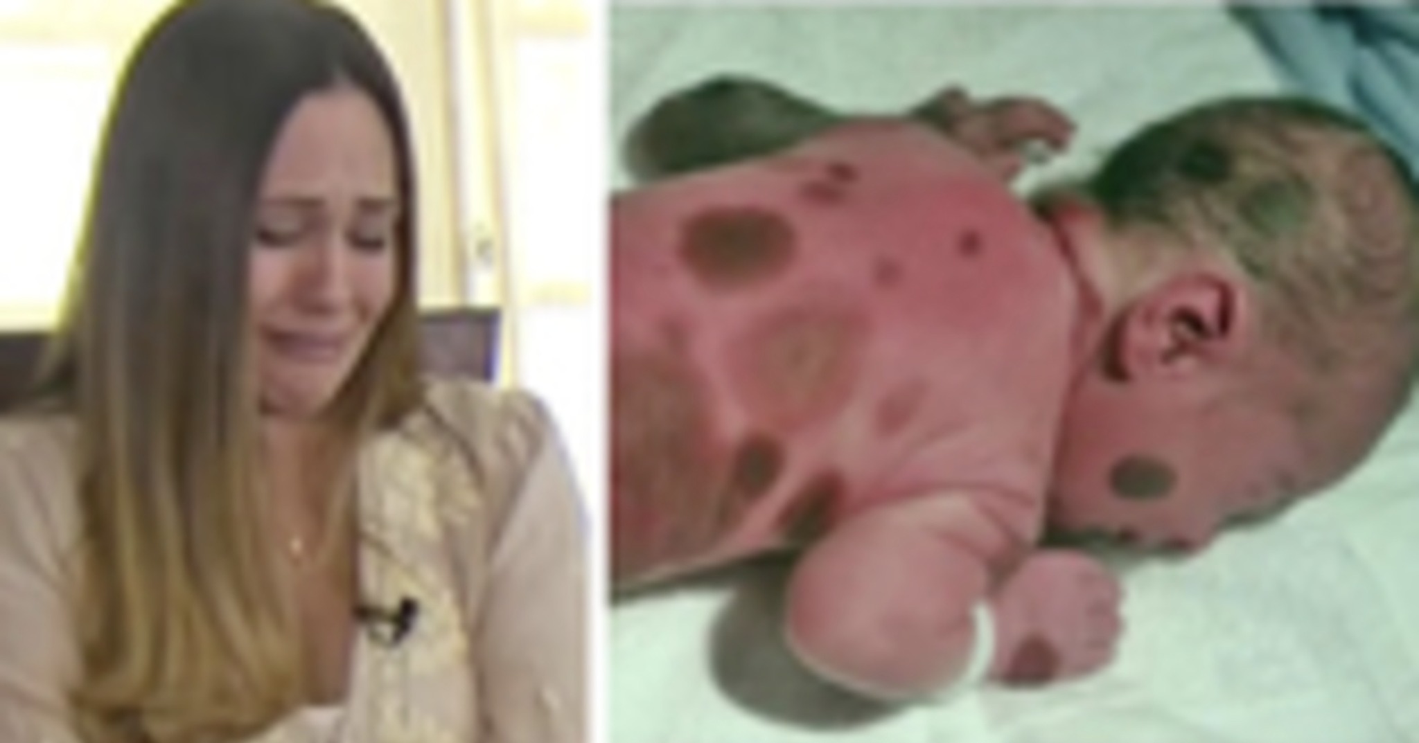 Read more about the article Mom of Baby Born with Rare Black Spots Stays Indoors from Shame—Now She’s Turning Pain into Power