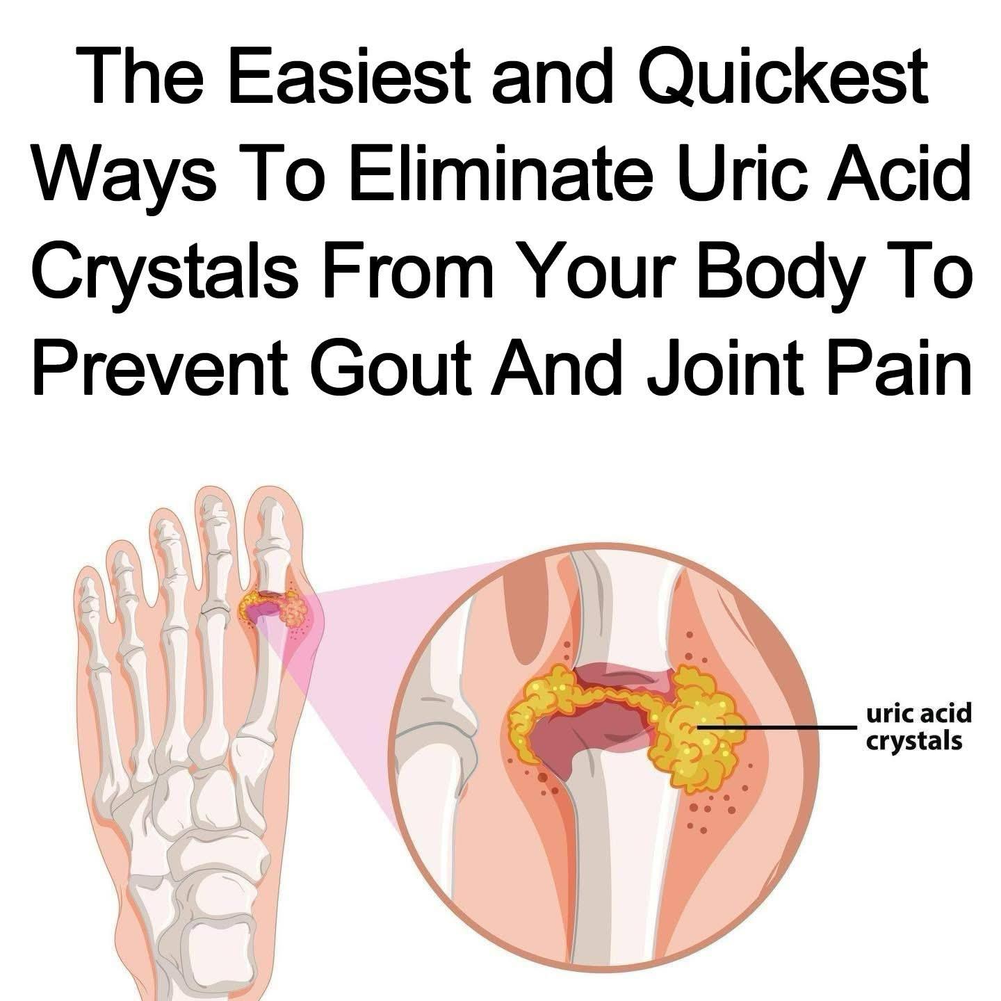 Read more about the article How to Help Naturally Relieve Gout and Joint Pain