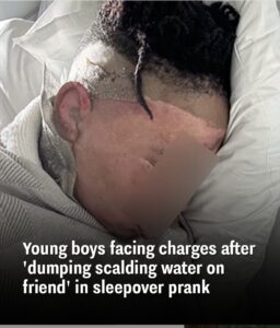 Read more about the article Georgia Boy Suffers Severe Burns in Sleepover Prank Gone Horribly Wrong — Now His Recovery Is Inspiring Thousands