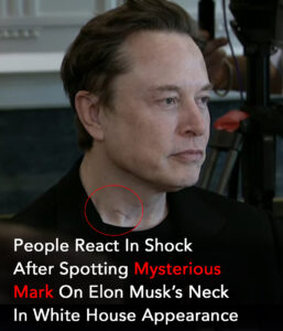 Read more about the article Elon Musk Sparks Frenzy with Bizarre Neck Mark and “Double Hat” Stunt at White House