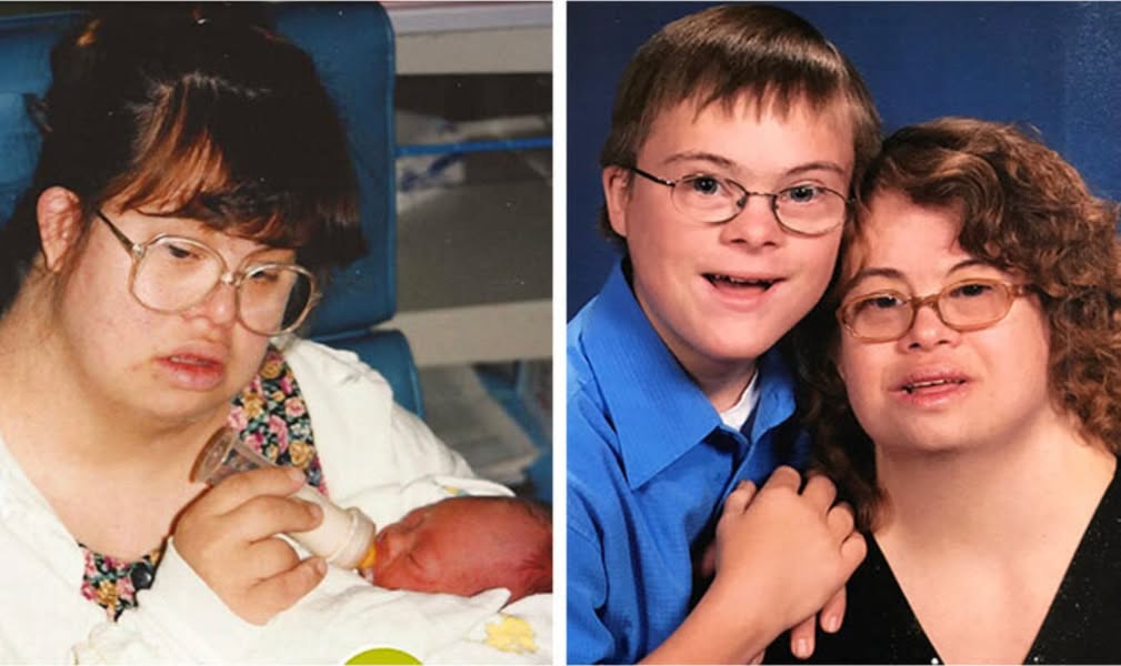 Read more about the article Couple With Down Syndrome Have a Child Despite Criticism — 24 Years Later, Their Story Is Inspiring Millions