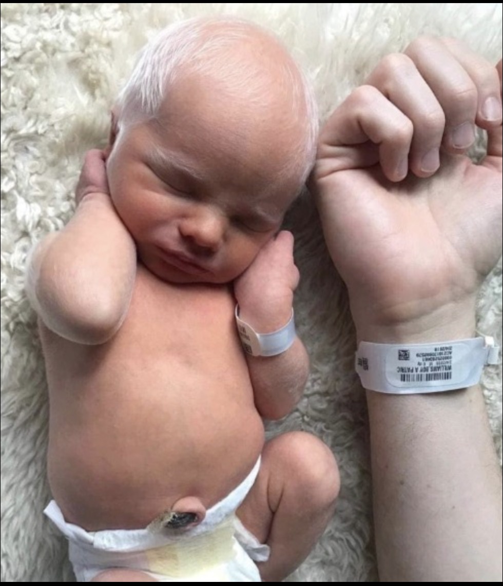 Read more about the article Albino Baby Once Mocked Online Now Thrives — A Story of Love, Awareness, and Triumph