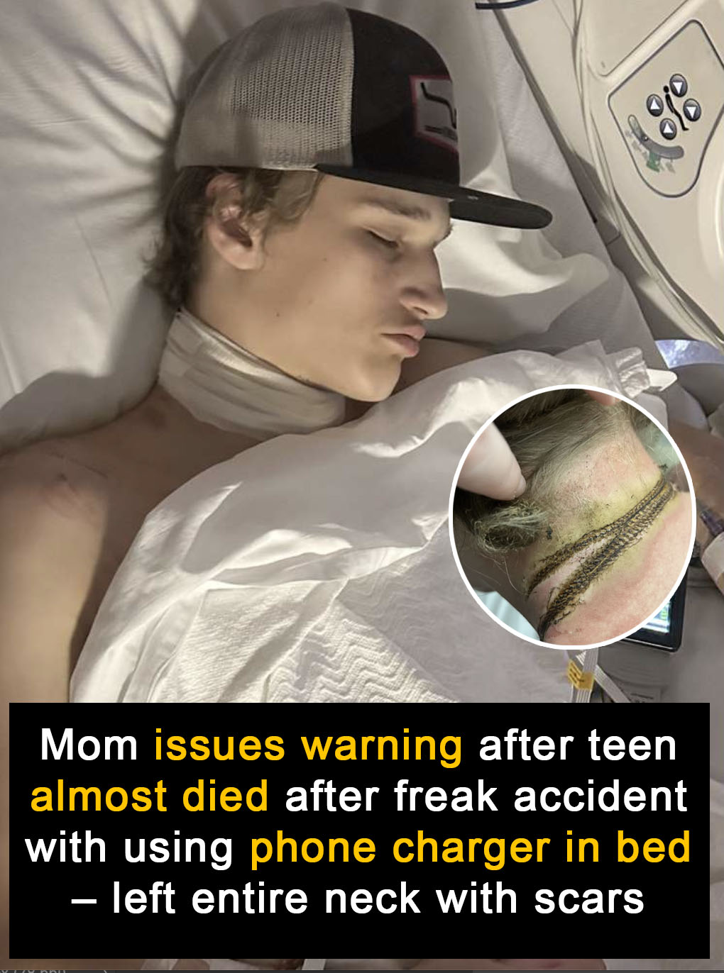 Read more about the article Mom Issues Urgent Warning After Son Is Nearly Electrocuted by Phone Charger in Bed