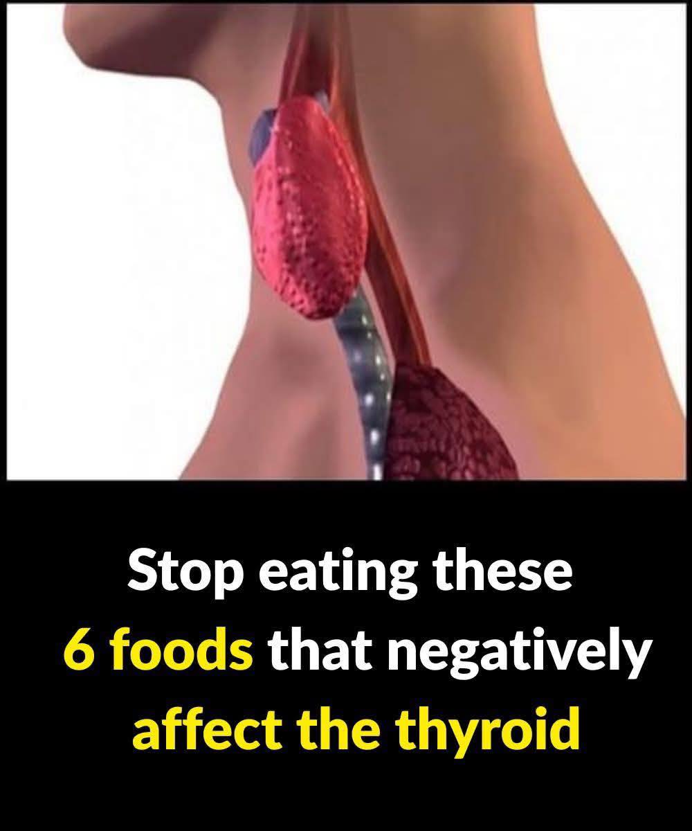 Read more about the article 6 Types of Foods That Negatively Affect Your Thyroid