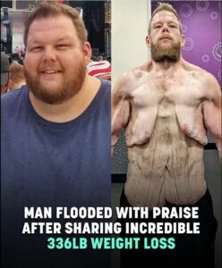 Read more about the article Man Loses 360 Pounds Naturally—Internet Rallies to Support His Next Step