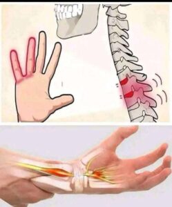 Read more about the article Waking Up With Tingling Hands? Here’s What It Could Mean