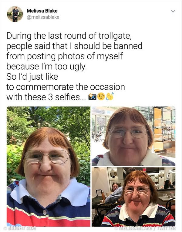 Read more about the article Woman Told She Was “Too Ugly” for Selfies Posts One Every Day for a Year — And Her Response Is Beautiful