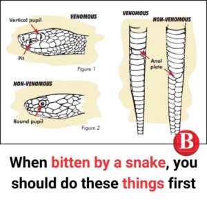 Read more about the article Snake bite signs and first aid you need to know