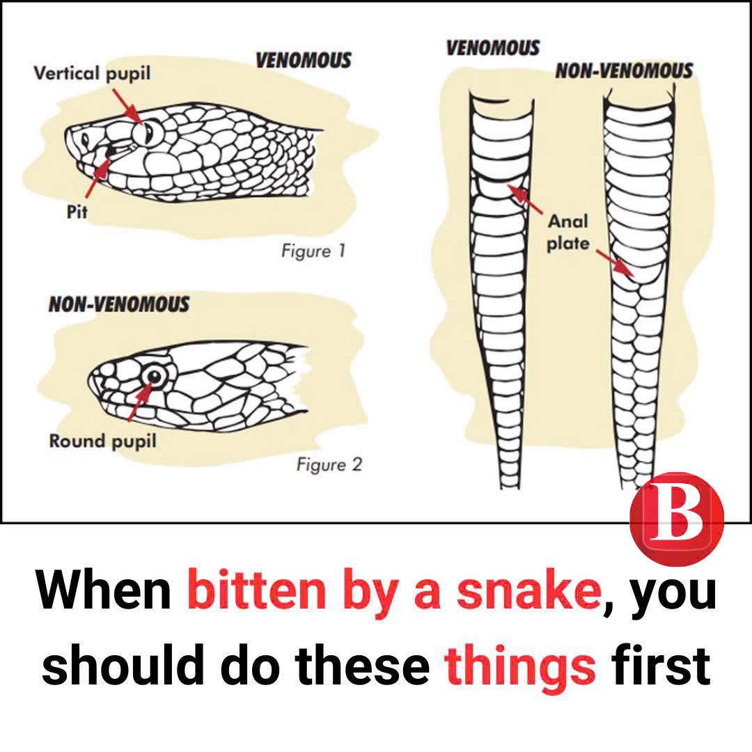 You are currently viewing Snake bite signs and first aid you need to know