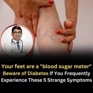 Read more about the article 10 Symptoms of Diabetes That May Appear in Your Feet