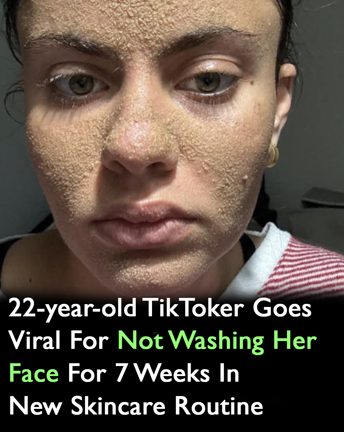 You are currently viewing TikTok Star’s No-Wash Skincare Goes Viral: What It Reveals About “Treatment” in Modern Wellness
