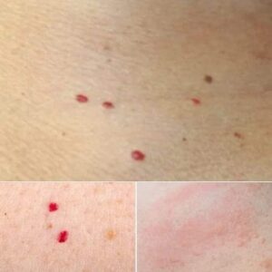 Read more about the article Red Dots on Your Skin? Here’s What They Might Mean – And When to Seek Help