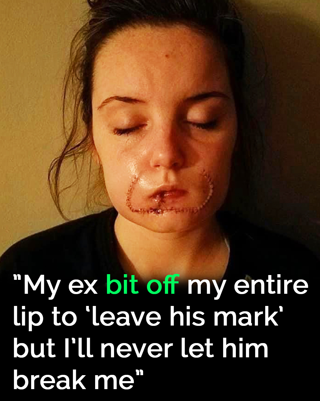 You are currently viewing Kayla Holmes: From Abusive Relationship to Survivor