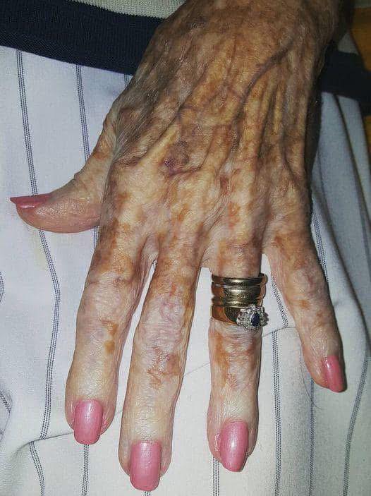 You are currently viewing The Truth About Beauty: A Heartwarming Story from a Nursing Home Worker