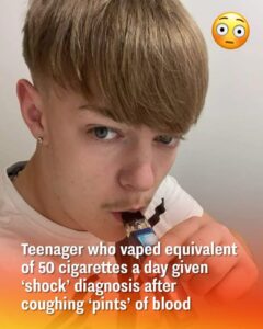 Read more about the article Teenager Vaping the Equivalent of 50 Cigarettes a Day Receives Shocking Diagnosis After Coughing Up ‘Pints’ of Blood