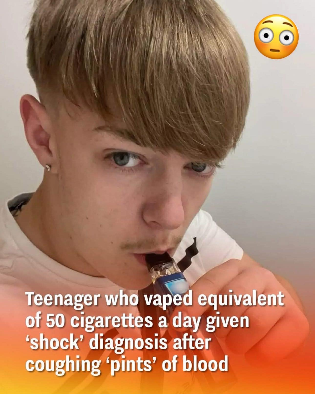 Read more about the article Teenager Vaping the Equivalent of 50 Cigarettes a Day Receives Shocking Diagnosis After Coughing Up ‘Pints’ of Blood