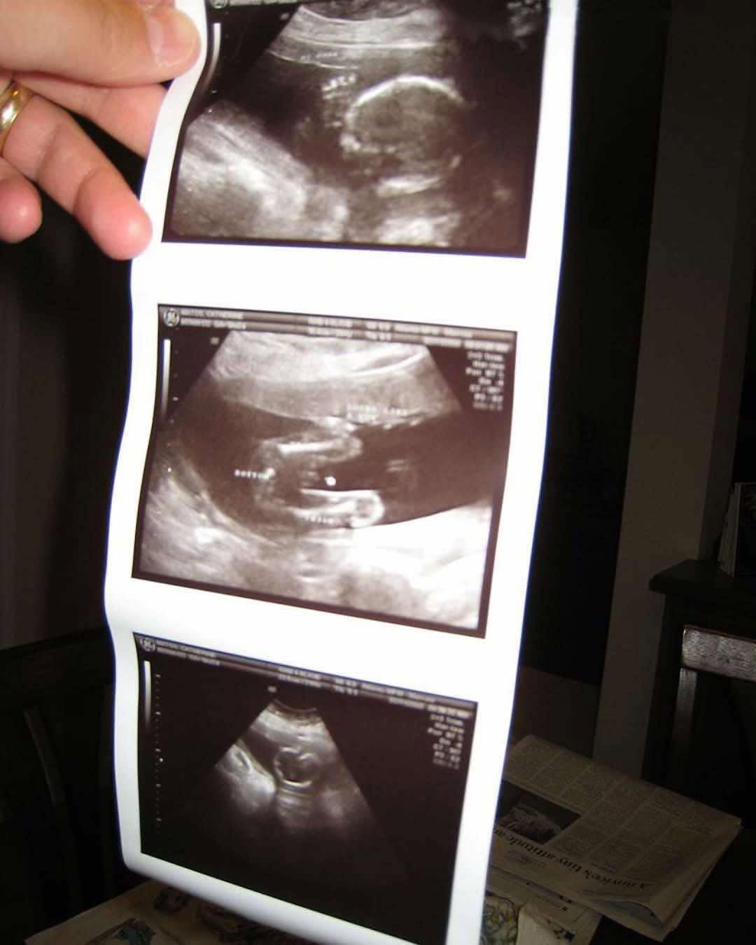 Read more about the article My Daughter Found a Picture in Her Dad’s Suitcase – It Made Me Faint
