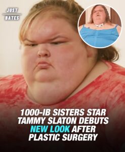 Read more about the article Tammy Slaton Unrecognizable After 500-Ib Weight Loss And Plastic Surgery