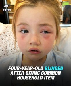 Read more about the article Toddler, 4, Blinded After Biting Common Household Item Mom Gave Her To Hold