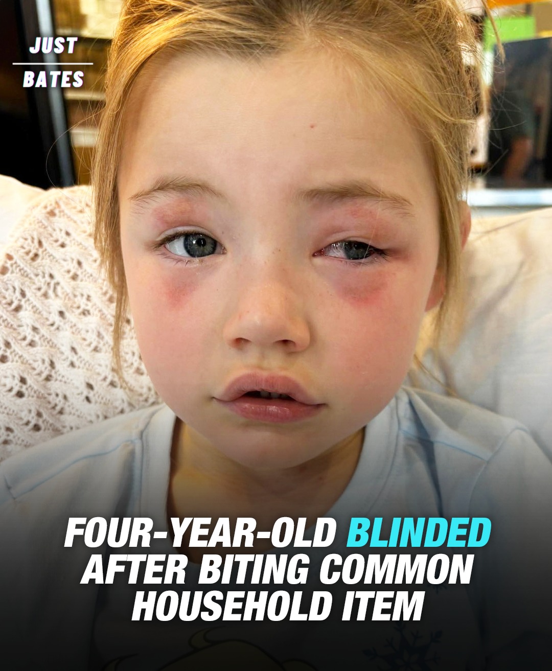 Read more about the article Toddler, 4, Blinded After Biting Common Household Item Mom Gave Her To Hold