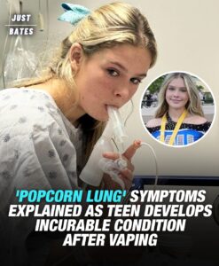 Read more about the article Title: Teenager Develops Incurable ‘Popcorn Lung’ After Vaping: Symptoms to Watch Out For